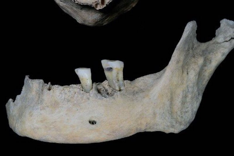 Diş Analizi, Demir Çağı Kadınının Diyetini Ortaya Koydu