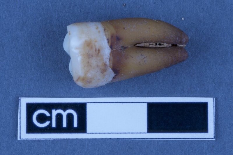Diş İzotopu, Avustralya’nın Sömürge Tarihini Aydınlatıyor