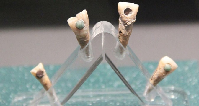 Antik Maya Uygarlığı Dişlerine Taktıkları Mücevherlerle Çürüklerin Önüne Geçmiş Olabilir