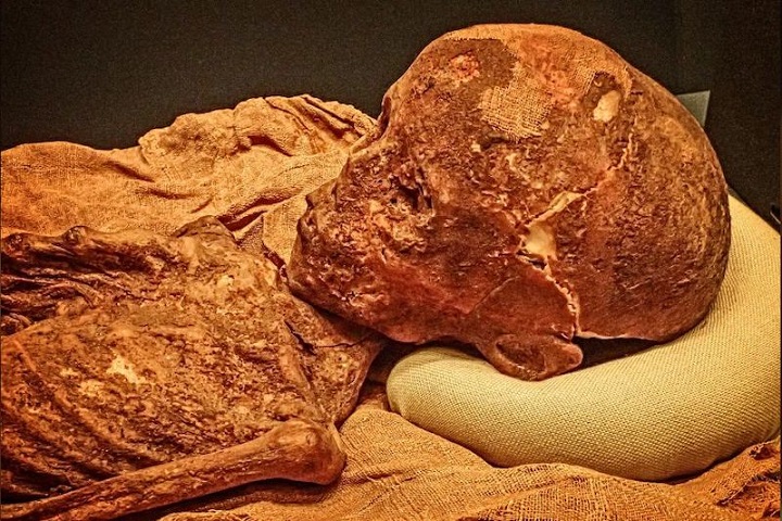 Antik Mısırlı Çocuklar Kan Hastalıklarıyla Boğuşuyordu
