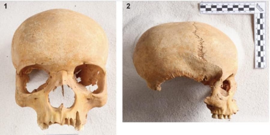Bohemya Orta Çağ Mezarlığında Afrika Kökenli Kadın Kafatası Bulundu