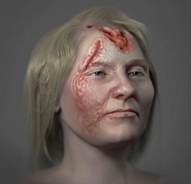500 Yıl Önce Frengi Olan Bir Kadının Yüzü Canlandırıldı