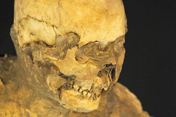 Herculaneum’daki Cesetler Neden İyi Korunamadı?