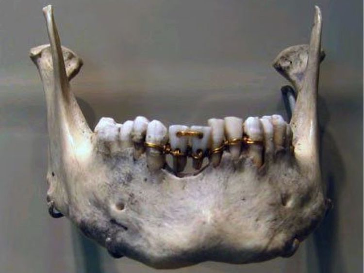 Antik Mısır’dan 1600 Yıllık Bilinen En Eski Diş Macunu Tarifini Deneyin