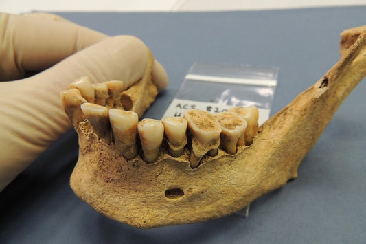 Antik DNA Arkeolojiyi Nasıl Dönüştürdü?
