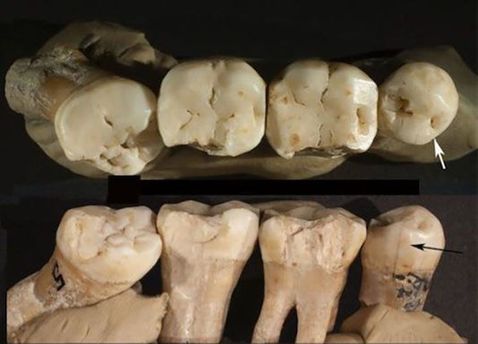 Neandertaller 130.000 Yıl Önce Kürdan Kullanıyordu