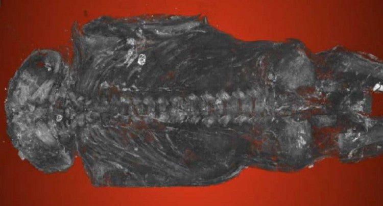 Şahin Olduğu Sanılan 2100 Yıllık Mumya Ölü Doğmuş Bebek Çıktı