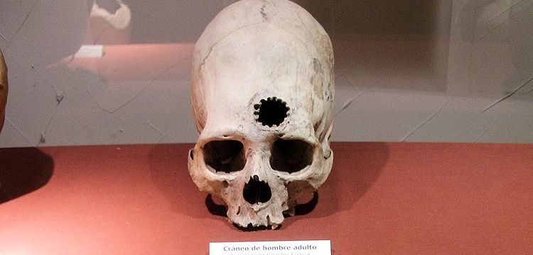 Amerikalı cerrahlar İnkalardan daha başarısız