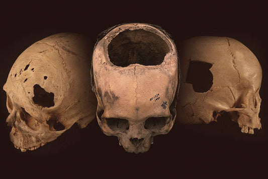 Antik Peru Cerrahlarının Şaşırtıcı Becerisi