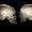 Neandertal DNA’sına Sahip Bazı İnsanların Kafası Daha Basık