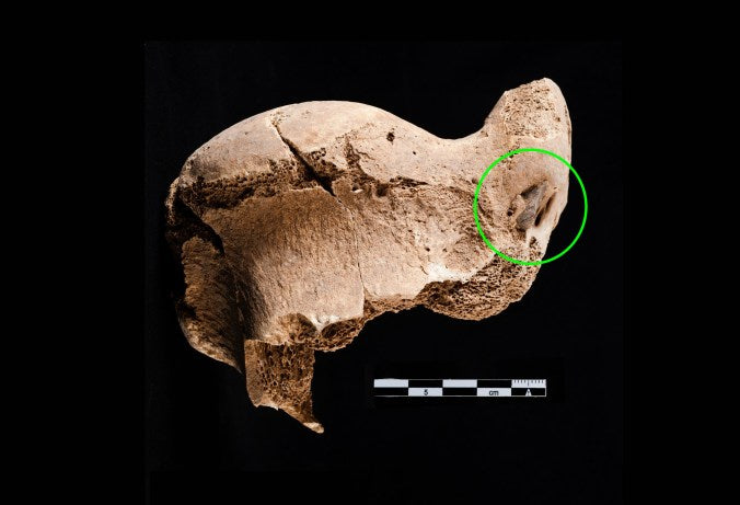 Göbeklitepe’de Çakmaktaşı Saplanmış Yaban Öküzü Kemiğ