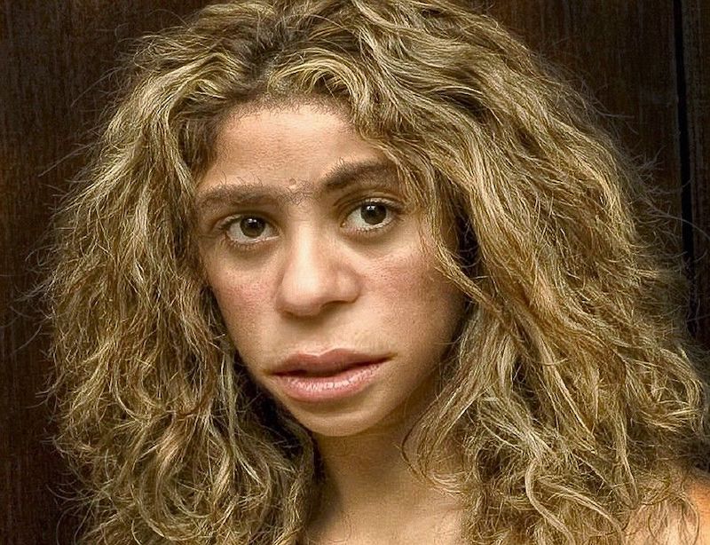 Neandertaller, Afrika’dan Taşıdığımız Hastalıklar Yüzünden Yok Oldu