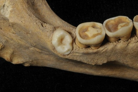 İspanya’da 4,500 Yıllık Neolitik İskelette Fazla bir Azı Dişi Bulundu