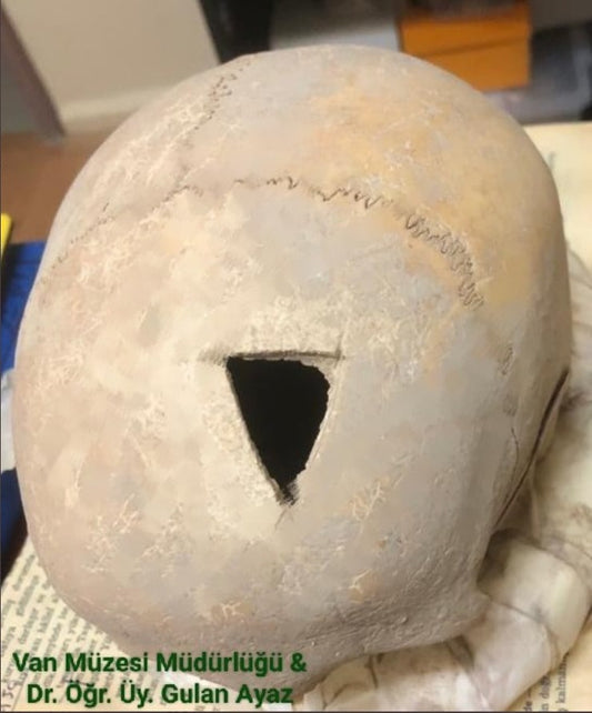 Aşıklı Höyük’ten sonra bir başka sıradışı trepanasyon (beyin ameliyatı) buluntusu Van’da keşfedildi