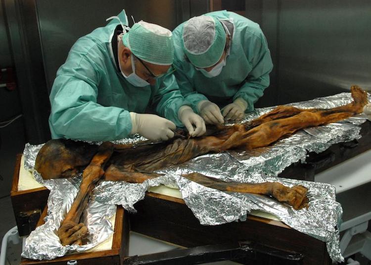 5300 Yıllık Buzadam Ötzi’nin Son Yedikleri Tespit Edildi