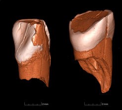 Fosil Süt Dişleri, Neandertallerin Yok Olmasında Modern İnsanın Rolü Olduğunu Gösteriyor