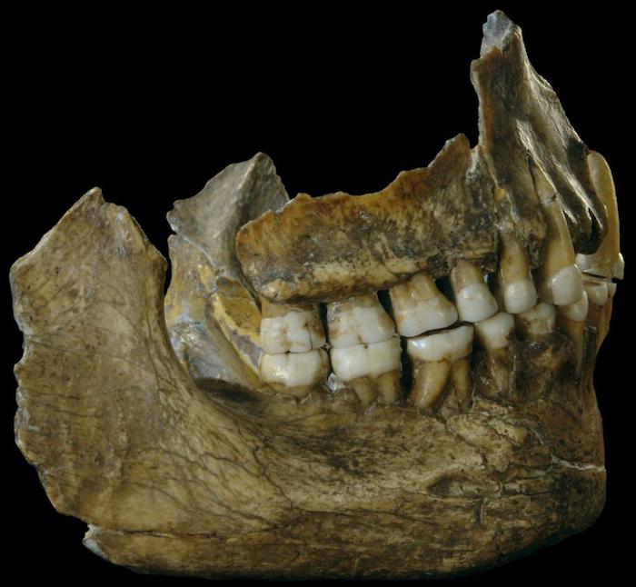 Neandertaller Tedavi için Penisilin ve Ağrı Kesici Kullanıyordu