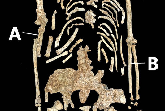 Australopithecus’un Önkol Eğriliği Doğal mı Patolojik miydi?