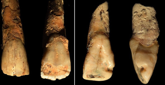 İtalya’da 4.500 Yıllık İskeletlerin Dişinde Kenevire Rastlandı