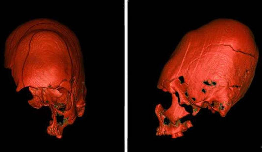 DNA, Avrupa’daki Sivri Kafataslarının Sırrını Çözebilir