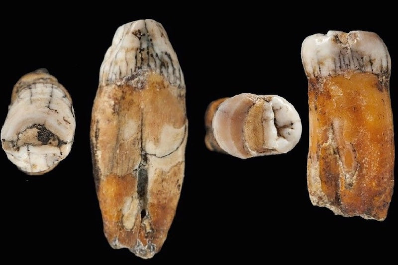 Bu Dişler, Modern İnsan-Neandertal Melezine Ait Çıktı