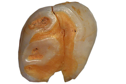 Neandertal Çocukları, Sapiens’e Benzer Şekilde Sütten Kesildi