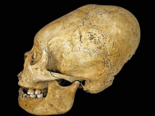 Antik Peru Halkı Statü Göstergesi Olarak Kafatası Şekillendiriyordu