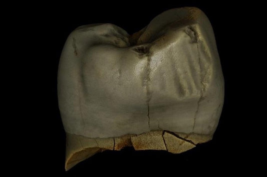 Neandertaller Bazılarımızın Aksine Dişlerine İyi Bakmış