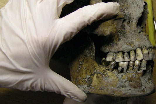 İsveç’teki Vikingler Diş Çürüklerinden Muzdaripti