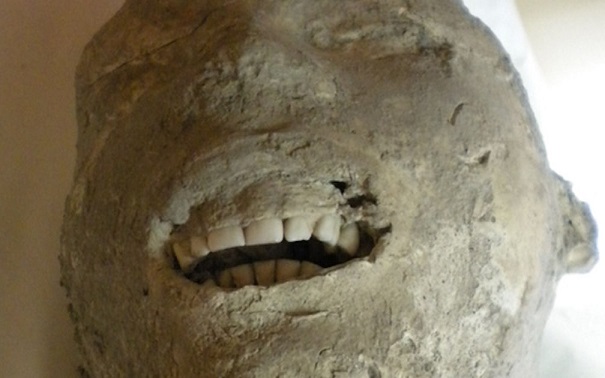 Antik Romalıların Dişleri Bizimkilerden Daha Sağlıklıydı