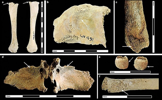 Roma Kentleşmesi Sağlık için Zararlıydı