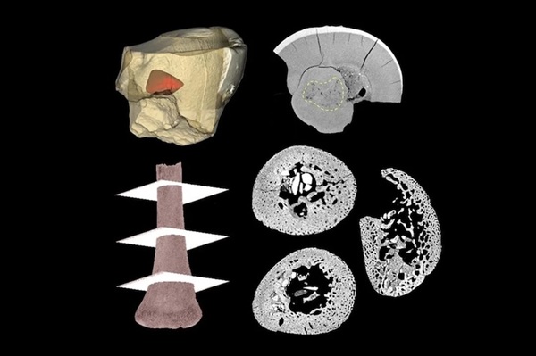 Neandertaller Ana Rahminde Nasıl Gelişiyordu?