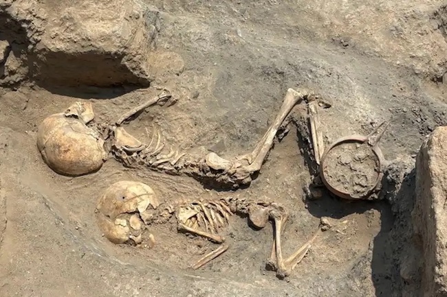 Özbekistan’da Tunç Çağı Çocuğuna Cerrahi Operasyon Yapılmış