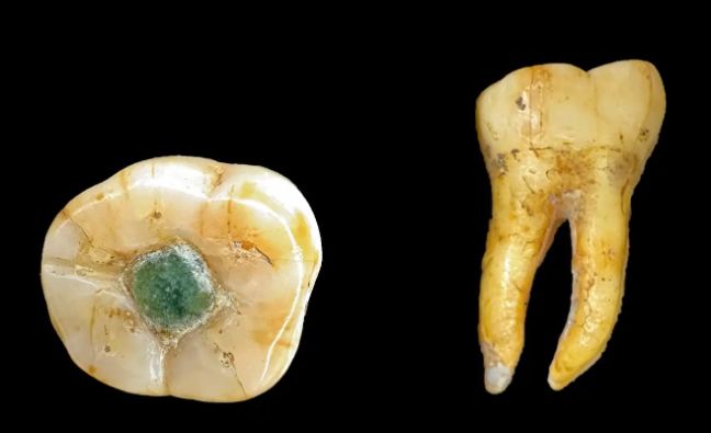 Antik Maya Diş Hekimliği: Azı Dişinde Değerli Taş Dolgusuna Dair İlk Kanıtlar Ortaya Çıktı