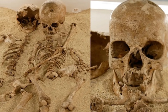 12.000 Yıl Önce Yaşamış Kızda Nadir Bir Cücelik Türü Vardı