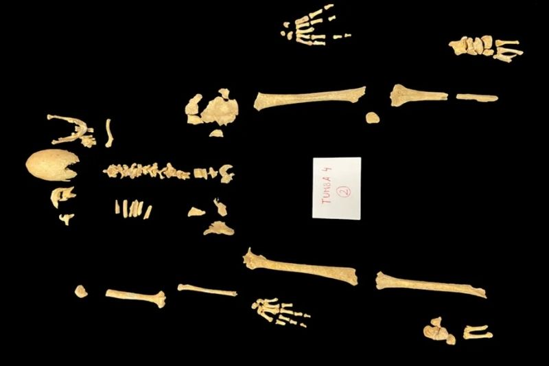 Savaşta Ölen Şövalyede Nadir Bir Genetik Hastalık Tespit Edildi