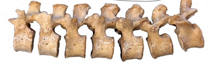 Sırtımız Neden Ağrıyor? Cevabı Neandertallerde Gizli Olabilir