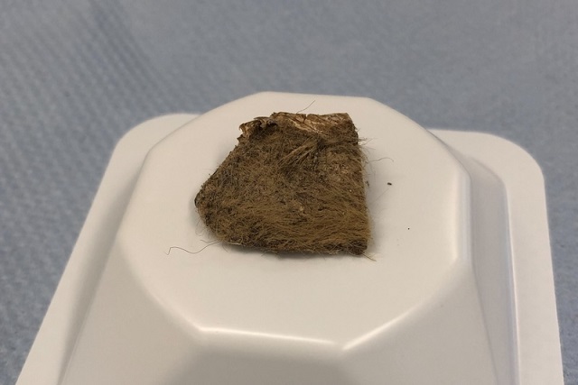 14.000 Yıllık Kurtun Midesinden Yünlü Gergedan Eti Çıktı