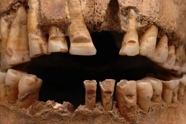 Vikingler Lonca Kabulü için Dişlerini Oymuş Olabilir